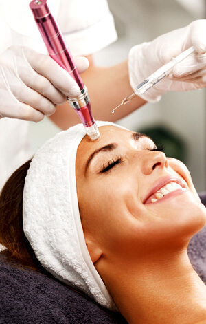 microneedling1